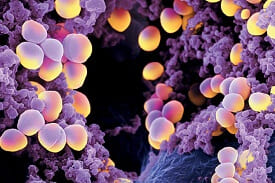 Зубні бактерії у ротовій порожнині