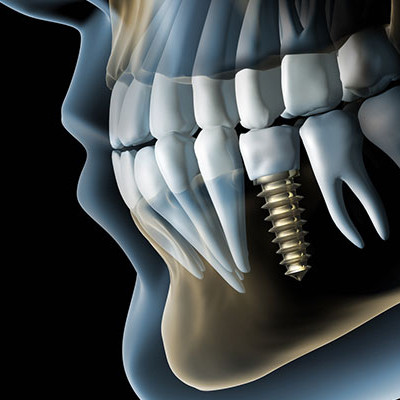 3д стоматологія – що це?