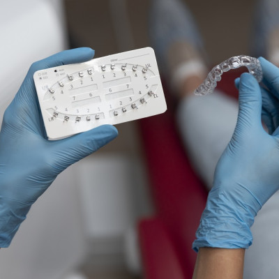 Выравнивание зубов