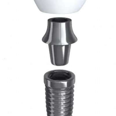 Сколько времени длится имплантация зубов