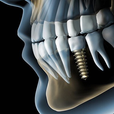 3д стоматология - что это?