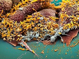 зубні бактерії