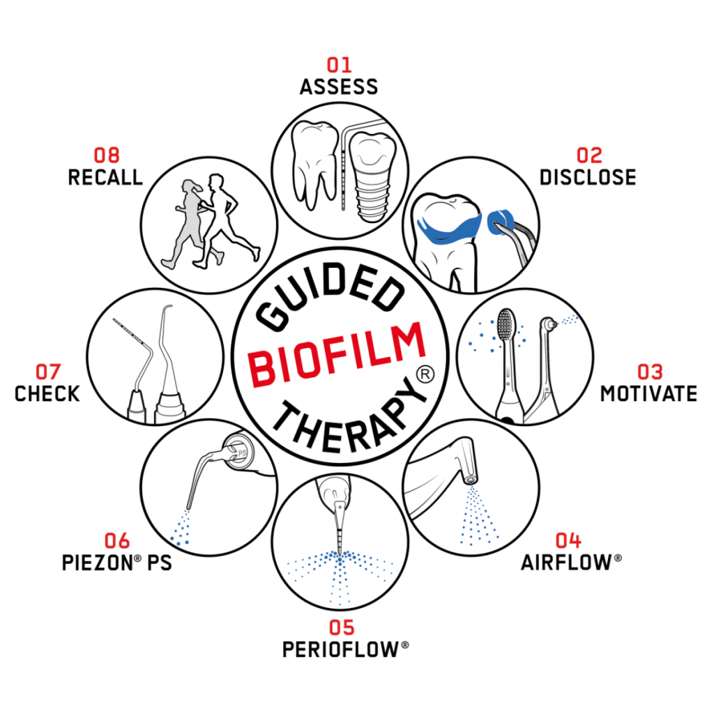 AIRFLOW® Prophylaxis Master